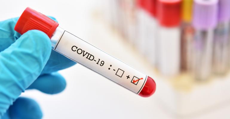 corona virus in test tube